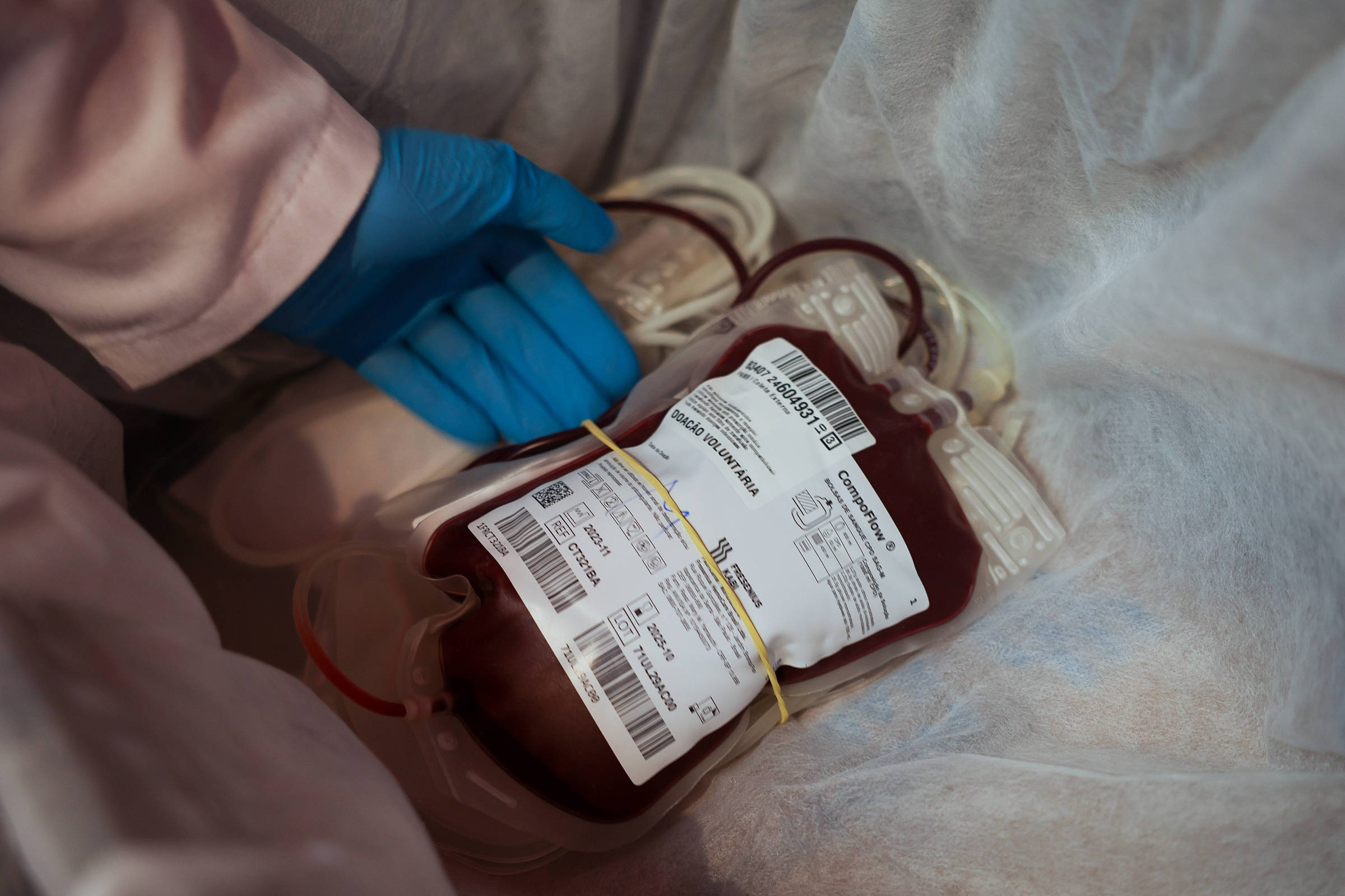 Unifesp implanta programa para evitar transfusão de sangue e reduz infecções hospitalares em 10%